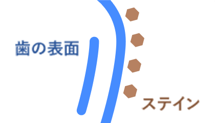 ホワイトニングの効果1